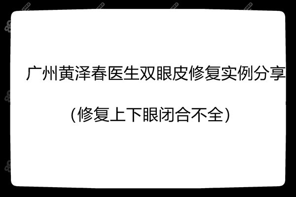 广州黄泽春医生做双眼皮修复实例