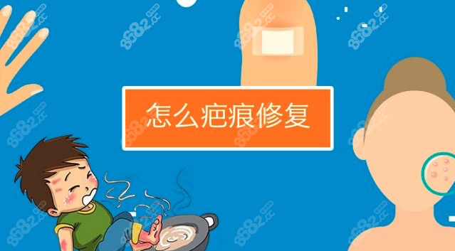 苏映军做疤痕修复还是很不错的