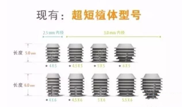 韩国duplo种植牙的质量怎么样