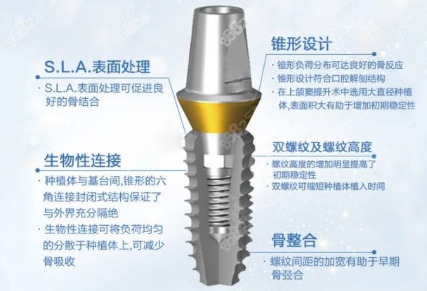 韩国登腾种植体的材料