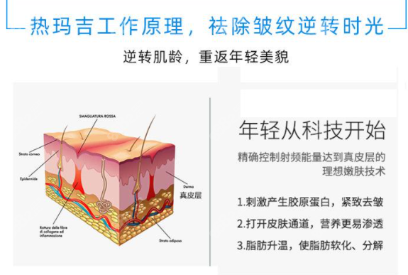 热玛吉5代术后有变化么