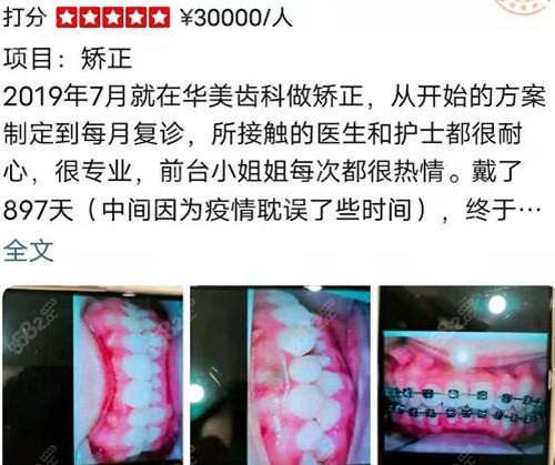 上海华美医院齿科牙友真实评价