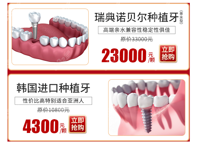 广东做瑞典诺贝尔亲水种植体价格