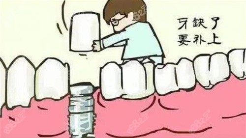 种植牙