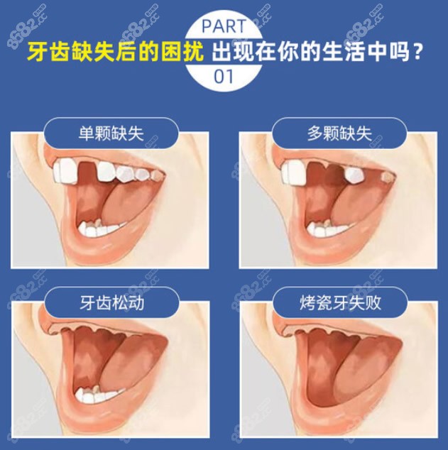 种植牙适合哪些人做