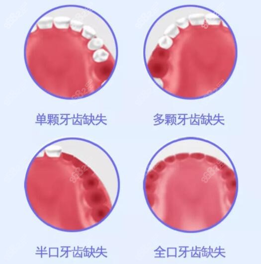 淄博可恩口腔医院价格表