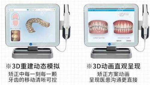 牙博士口腔牙齿矫正技术优势