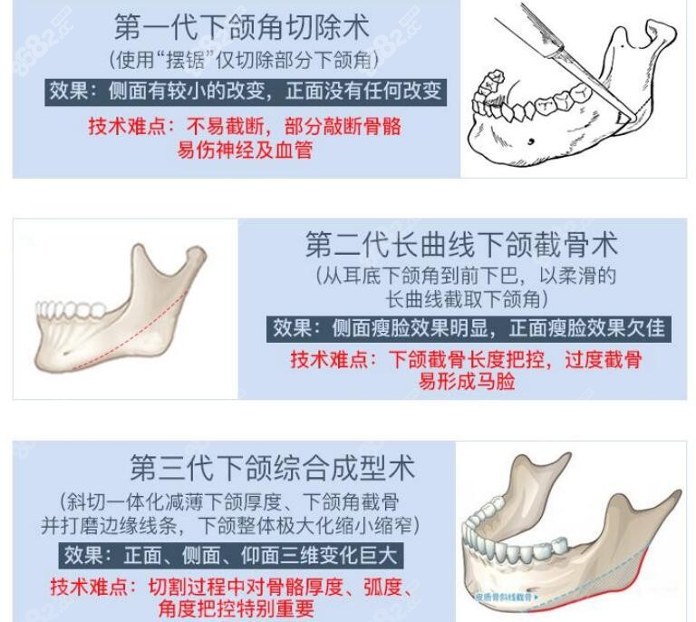 重庆时光<!--<i data=20240705-sp></i>-->磨骨技术特色