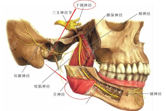 郑志雄做下颌角优势