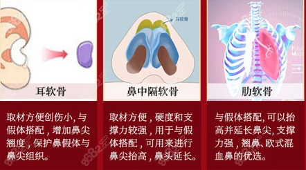 自體軟骨組織材料展示圖