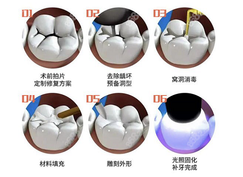 咸阳儿童看牙排名医院是哪家？<!--<i data=20240705-sp></i>-->齿科补牙流程