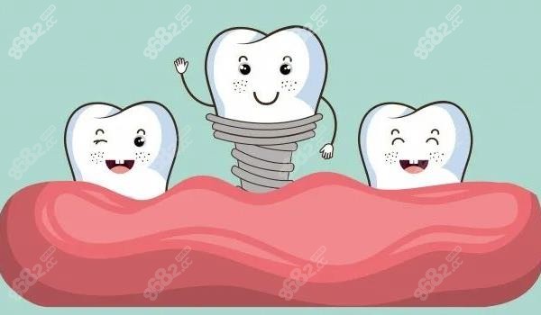 种植牙流程介绍