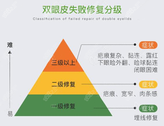 双眼皮失败修复等级