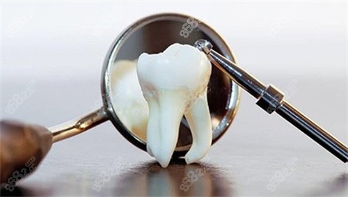 牙周治疗示意图