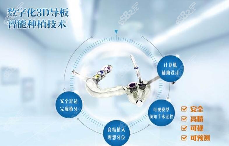 杭州美奥口腔数字化种植技术