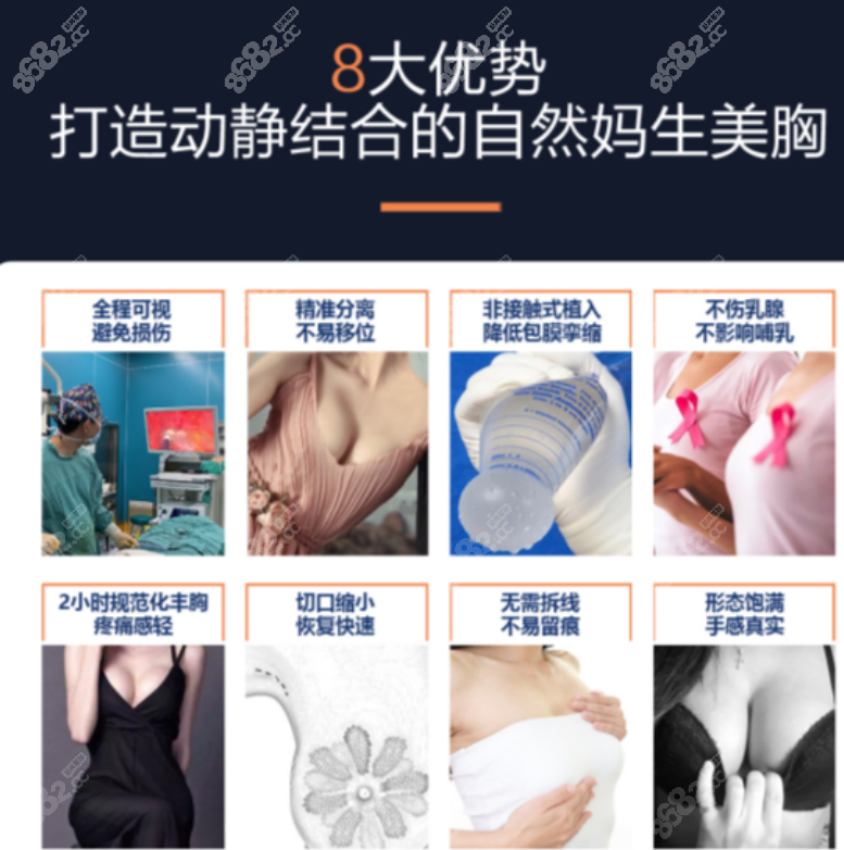 唐毅医生做隆胸手术的几个优点