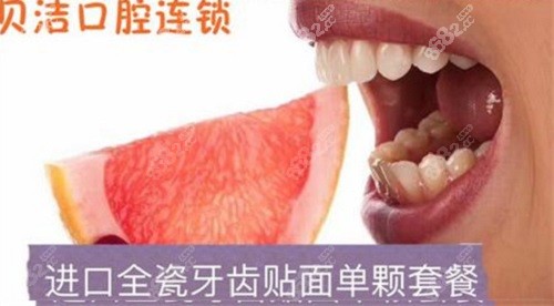 昆明贝洁单颗进口全瓷贴面