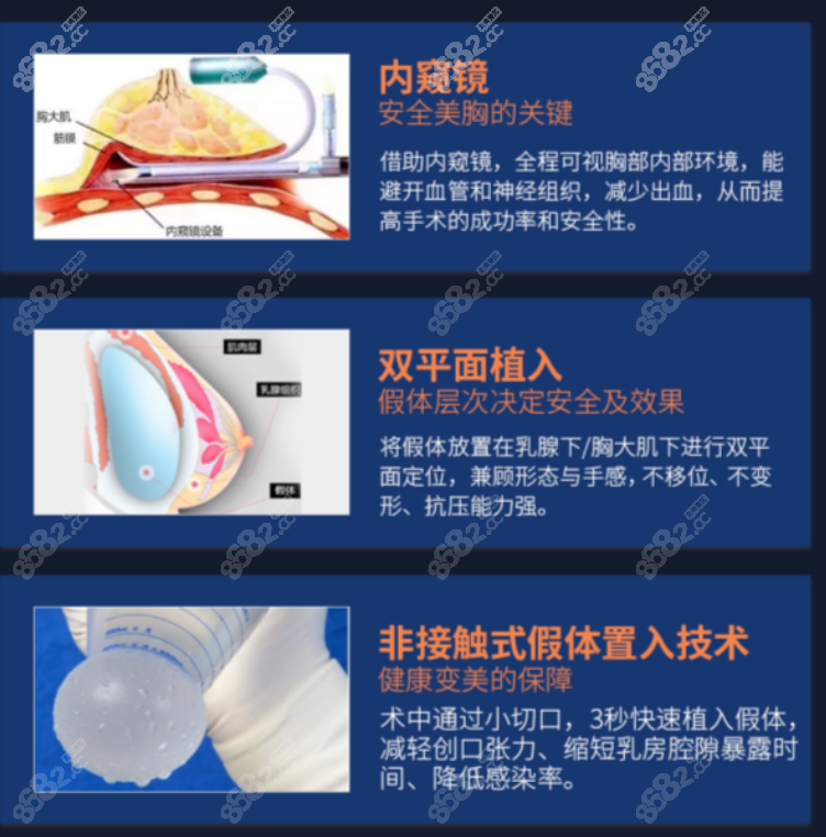 上海唐毅隆胸怎么样？
