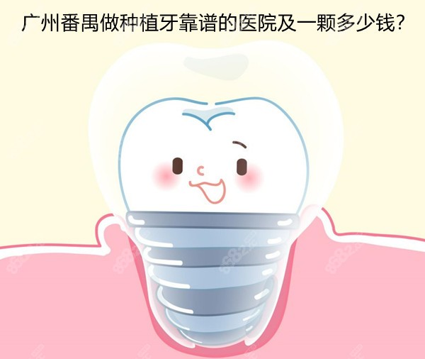 广州番禺做种植牙靠谱的医院