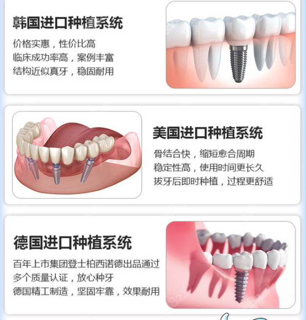 德国、美国、韩国进口种植牙系统对比