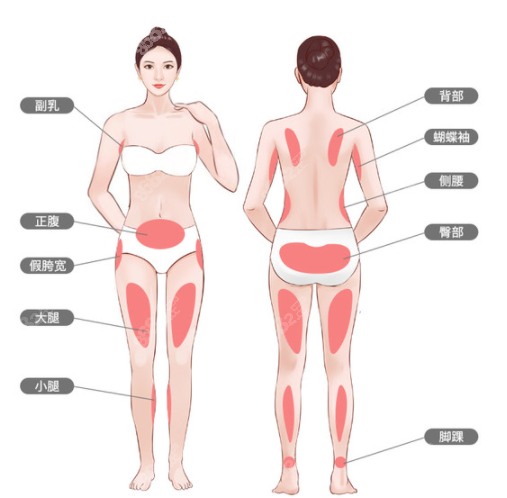 合肥维多利亚做腰腹部吸脂多少钱如果用水动力抽脂价格是