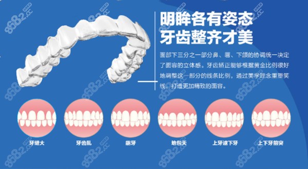 東營恩格口腔牙齒矯正的優(yōu)勢(shì)