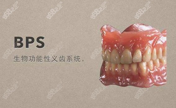 bps义齿系统
