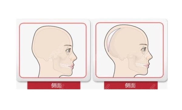 国内哪些医院可以做填充后脑勺手术