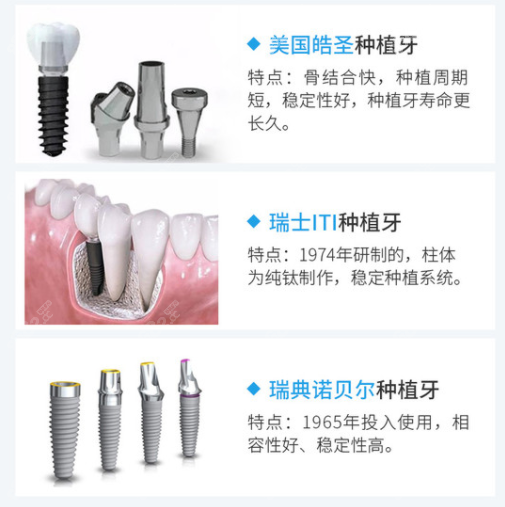 美国、瑞士、瑞典种植体对比