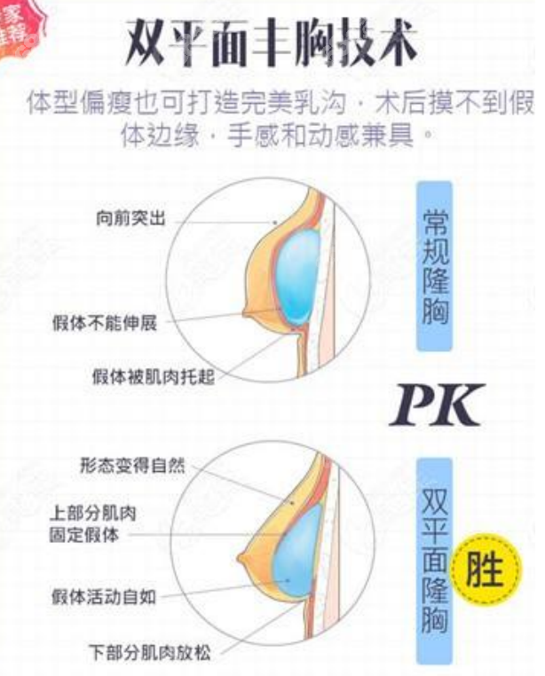 郭震宇医生做假体隆胸的优势