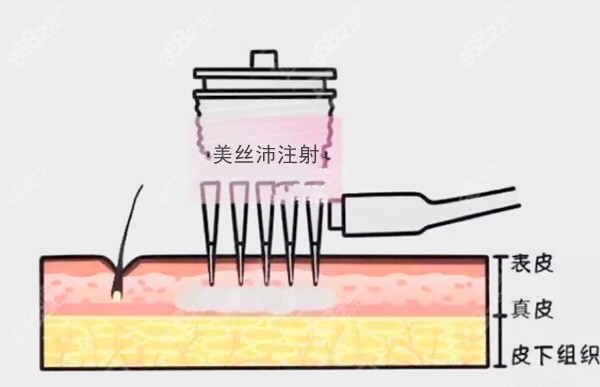 碧莲盛美丝沛<span style=