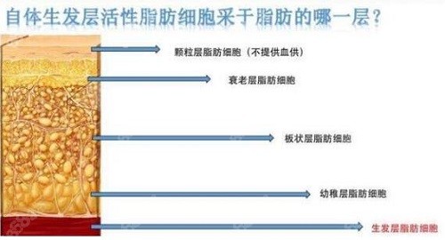 白晋crt丰胸选取脂肪