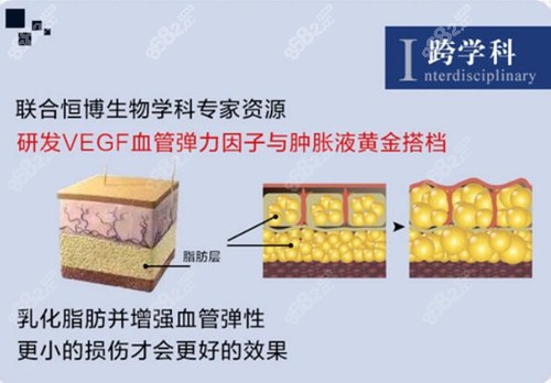 成都恒博天姿吸脂优势介绍