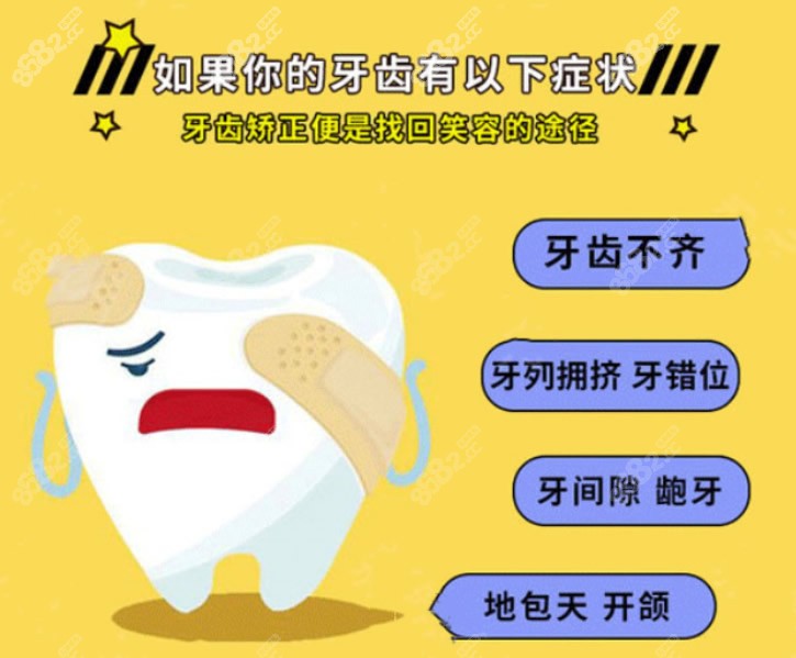牙齿矫正适合哪些人做