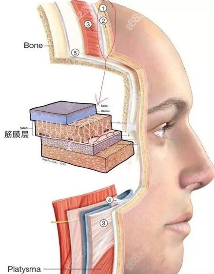 黄寅守做拉皮怎么样