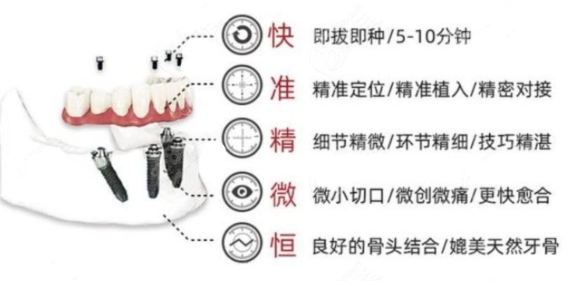 杭州全口种植牙技术