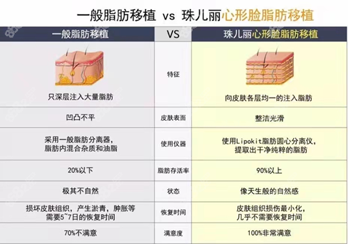 韩国珠儿丽整形外科医院脂肪填充怎么样