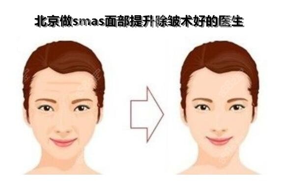 北京做smas面部提升除皱术好的医生