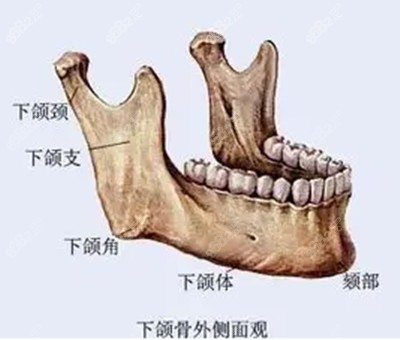 李运峰医生做颧骨颧弓整形的技术优势2