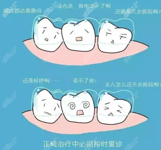 正畸需要及时复诊 正畸需要及时复诊