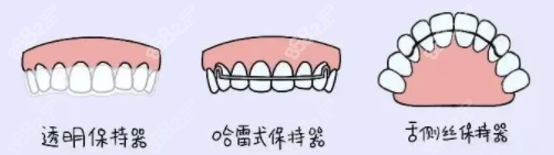 矫正器的类型 矫正器的类型