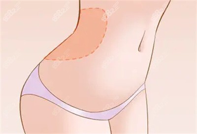 2022常州美貝爾整形醫(yī)院吸脂參考價(jià)格