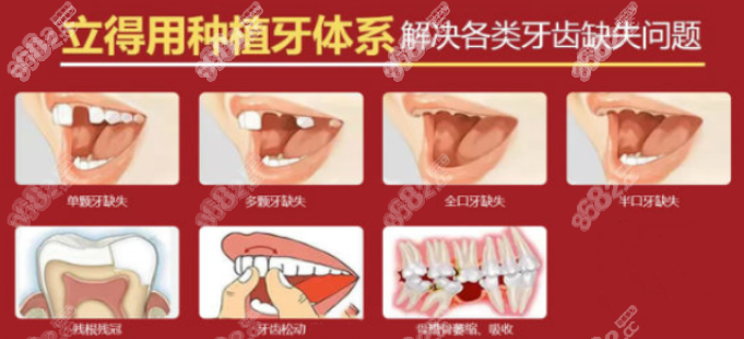 西安中诺的立得用种植技术