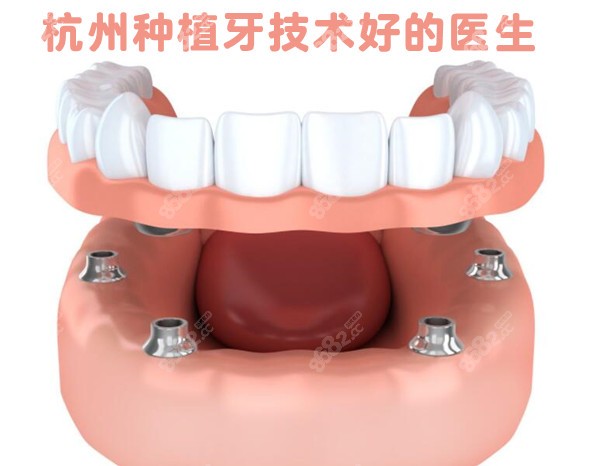 杭州做种植牙技术比较好的医生