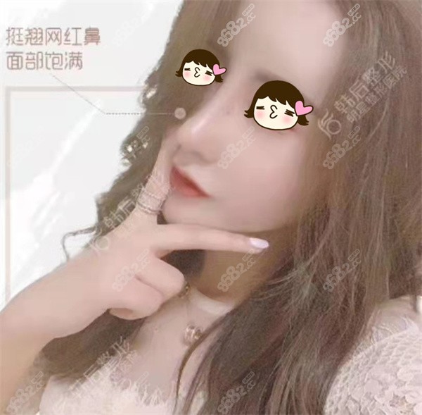 广州崔东做鼻修复怎样？