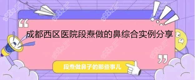 成都西区医院段焘医生做的肋软骨鼻综合实例