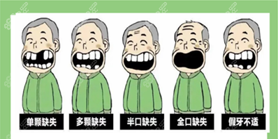 缺牙图