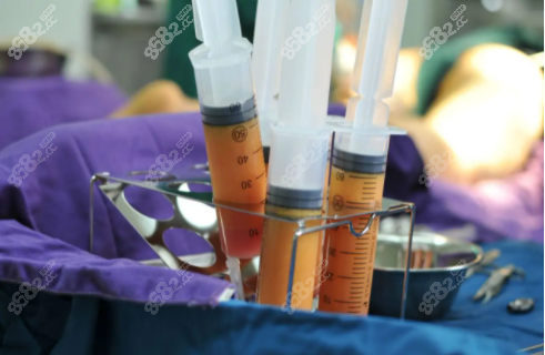 孙泽芳医生吸脂吸出的脂肪颜色金黄
