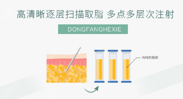 高清晰自动扫描取脂肪