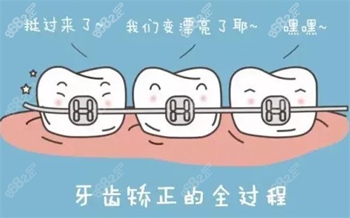 牙齿矫正后